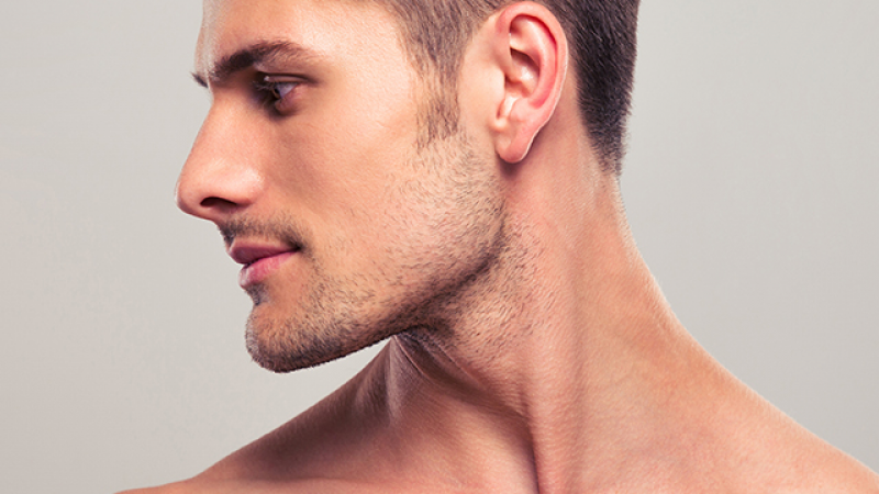 A sharp and masculine jawline with jawline filler in men