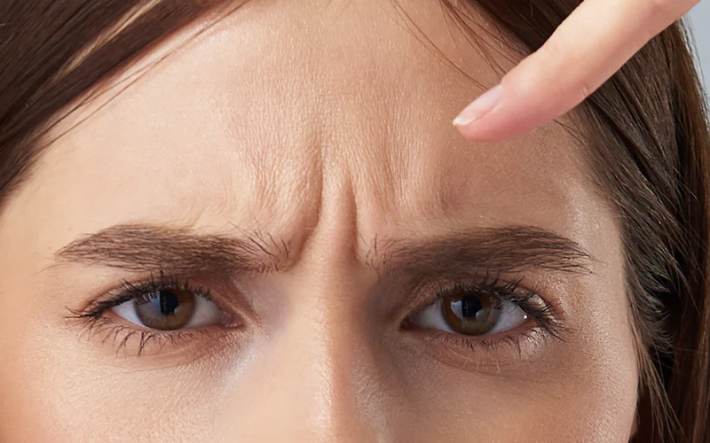 Botox for forehead and frown lines