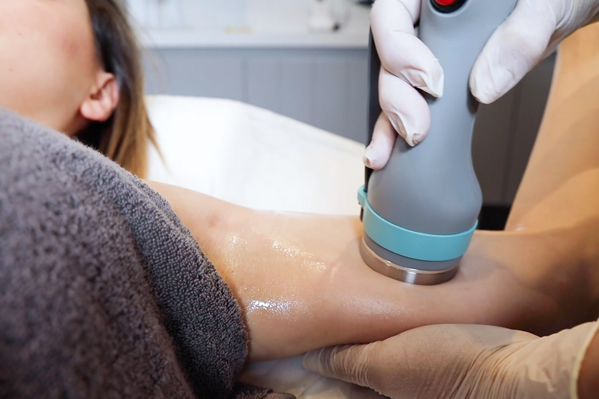 Verbesserung von Gewebefestigkeit und Cellulite-Erscheinungsbild nach einer Onda-Coolwaves-Sitzungsserie