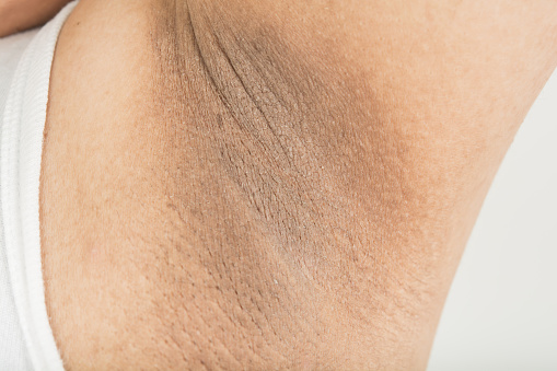 Skin tone evening and darkening treatment