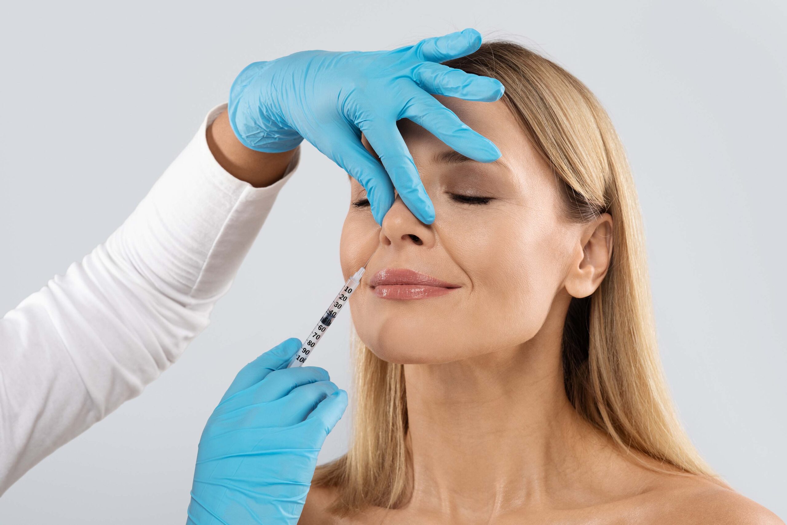 Filler-Behandlung von Marionettenfalten